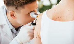 Cilt Kanseri Belirtileri Nelerdir? Cilt Kanseri Tedavisi