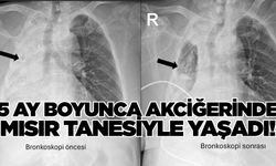 5 ay boyunca mısır tanesi ile yaşadı