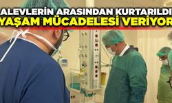 Yangından sağ kurtulan Kader Dereli hayat mücadelesi veriyor