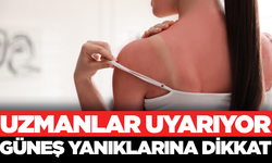 Güneş yanıkları deri kanseri riskini artırıyor