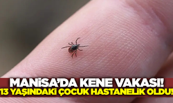 Manisa'da kene alarmı! 13 yaşındaki çocuk tedavi altına alındı