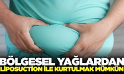 Liposuction yöntemiyle bölgesel yağlardan kurtulmak mümkün