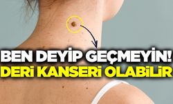 'Ben' aldırmada lazer ve asitli solüsyonlar ciddi risk taşıyor