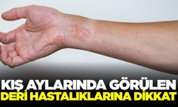 Kış ayları deri hastalıklarına davetiye çıkartıyor