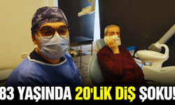 Manisa’da 83 yaşında çıkan 20’lik diş, doktoru şaşırttı!
