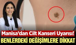 Manisa Şehir Hastanesi’nden cilt sağlığı için kritik açıklama