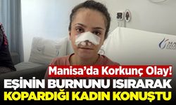 Manisa'da eşi burnunu ısırıp koparmıştı: Ameliyatla yerine dikildi
