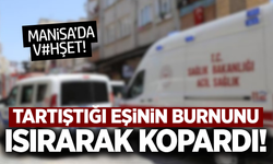 Manisa’da karısının burnunu ısırarak kopardı!