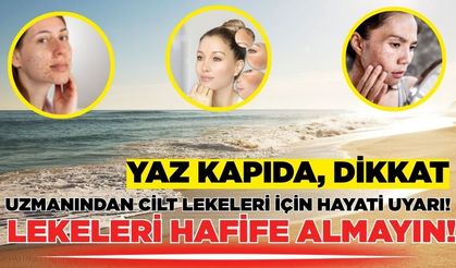 Cilt lekelerine dikkat: Uzmanından kritik uyarı!
