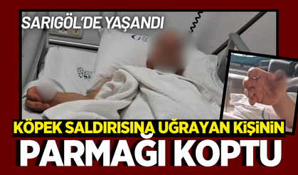 Sarıgöl'de köpek saldırısına uğrayan kişinin parmağı koptu!