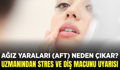 Aft nedir, nasıl geçer? İşte detaylar