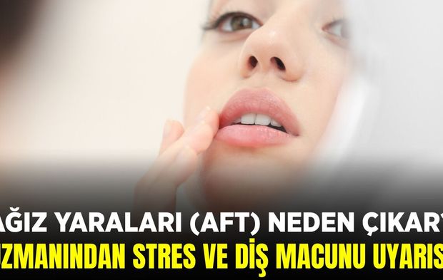 Aft nedir, nasıl geçer? İşte detaylar