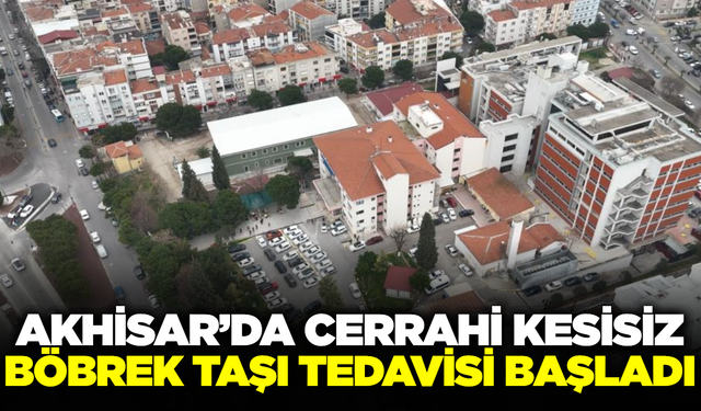 Akhisar'da böbrek taşı tedavisinde yeni dönem