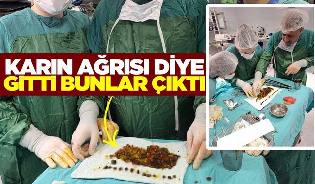 Manisa'da şaşırtan ameliyat: Safra kesesinden binlerce adet çıktı
