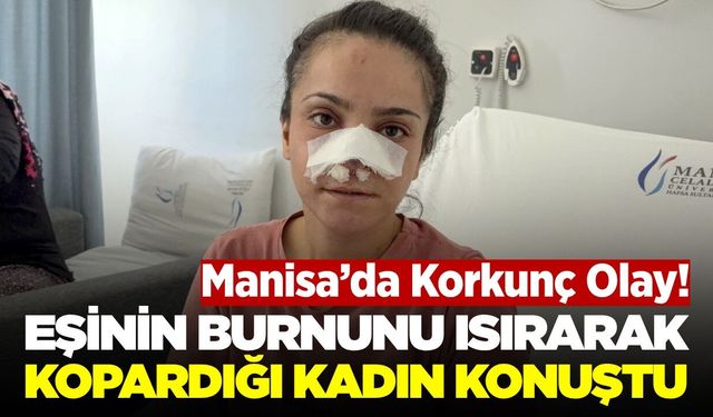 Manisa'da eşi burnunu ısırıp koparmıştı: Ameliyatla yerine dikildi