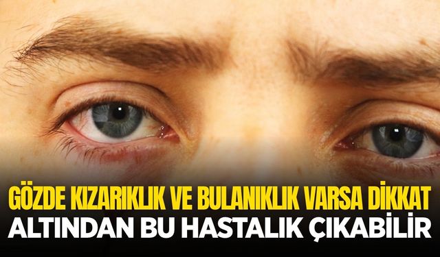 Gözde kızarıklık ve bulanıklık varsa dikkat: İşte detaylar