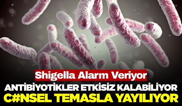 Tedavisi Giderek Zorlaşıyor: Uzmanları Endişelendiren Bakteri! Shigella...