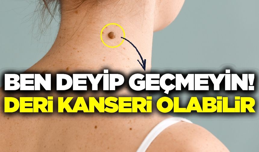 'Ben' aldırmada lazer ve asitli solüsyonlar ciddi risk taşıyor