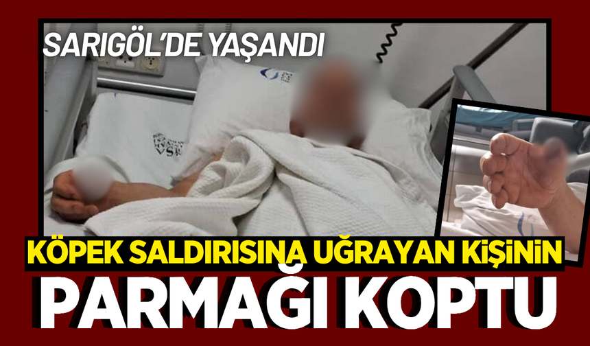 Sarıgöl'de köpek saldırısına uğrayan kişinin parmağı koptu!