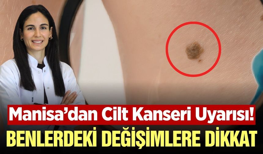 Manisa Şehir Hastanesi’nden cilt sağlığı için kritik açıklama
