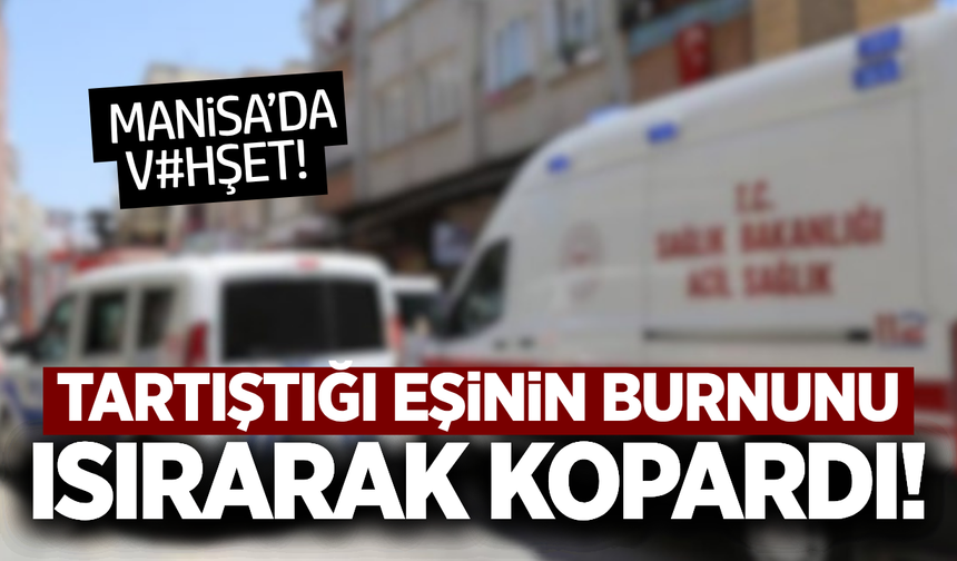 Manisa’da karısının burnunu ısırarak kopardı!