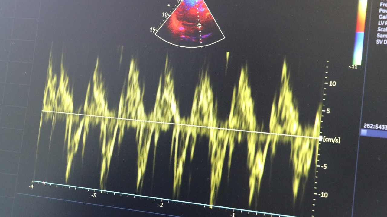 Soğuk Havalar Kalp Hastaları Için Riski Biraz Daha Artırıyor .1