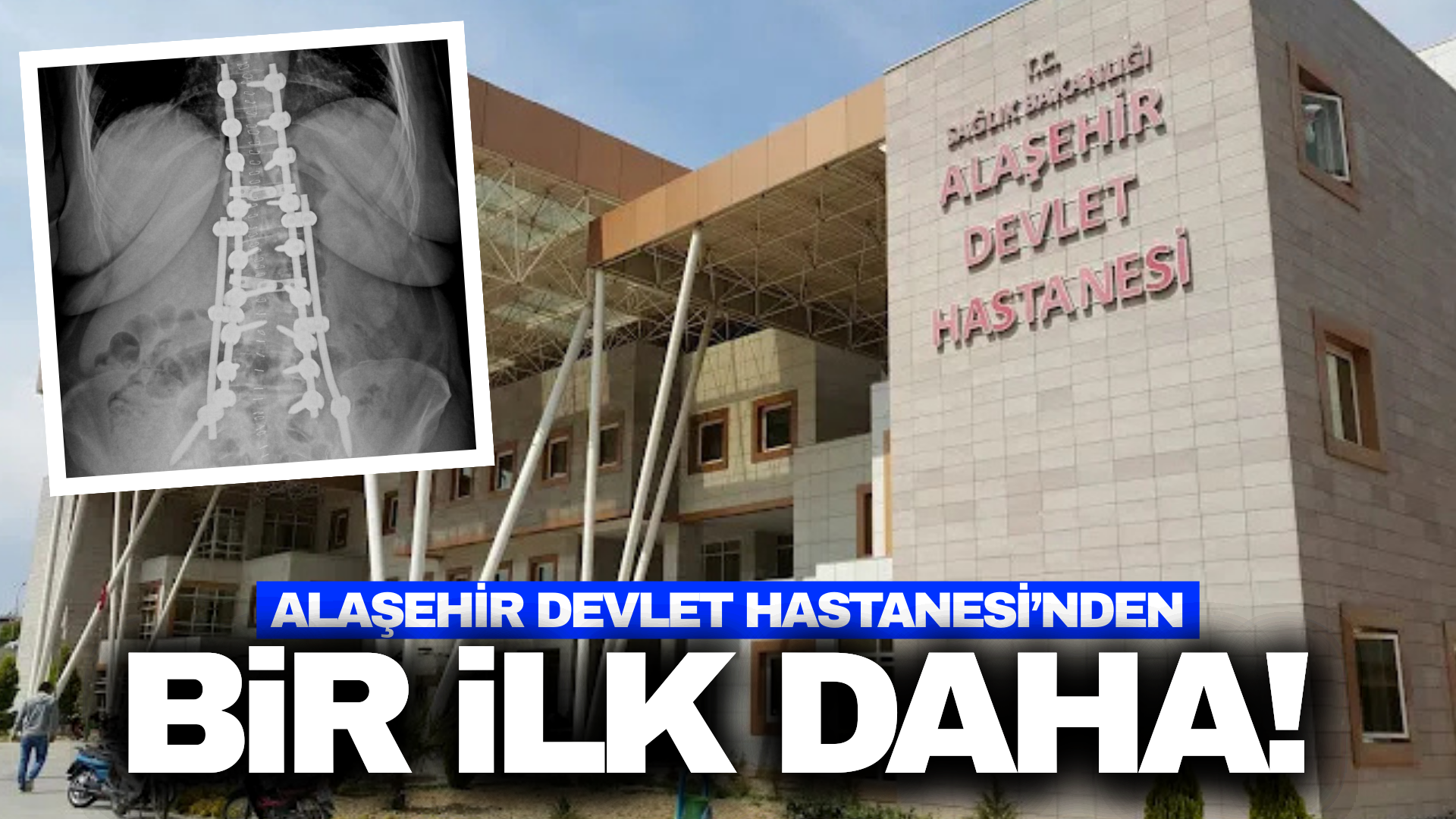 Alaşehir Devlet Hastanesi'nden bir ilk!
