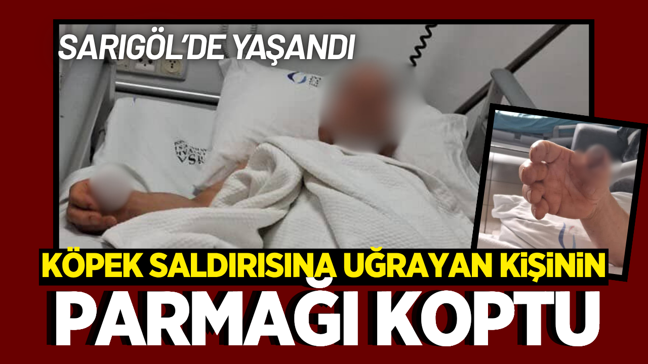 Sarıgöl'de köpek saldırısına uğrayan kişinin parmağı koptu!