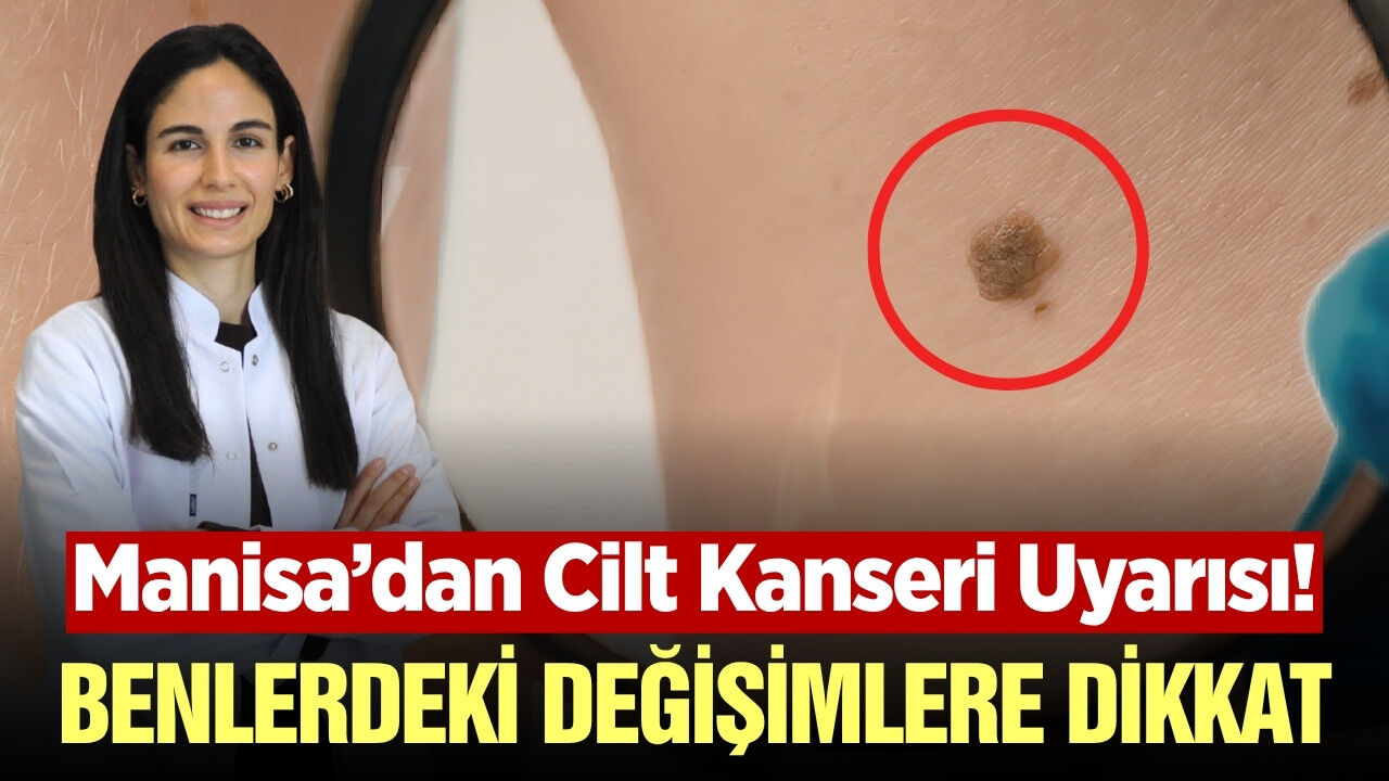 Manisa Şehir Hastanesi’nden cilt sağlığı için kritik açıklama