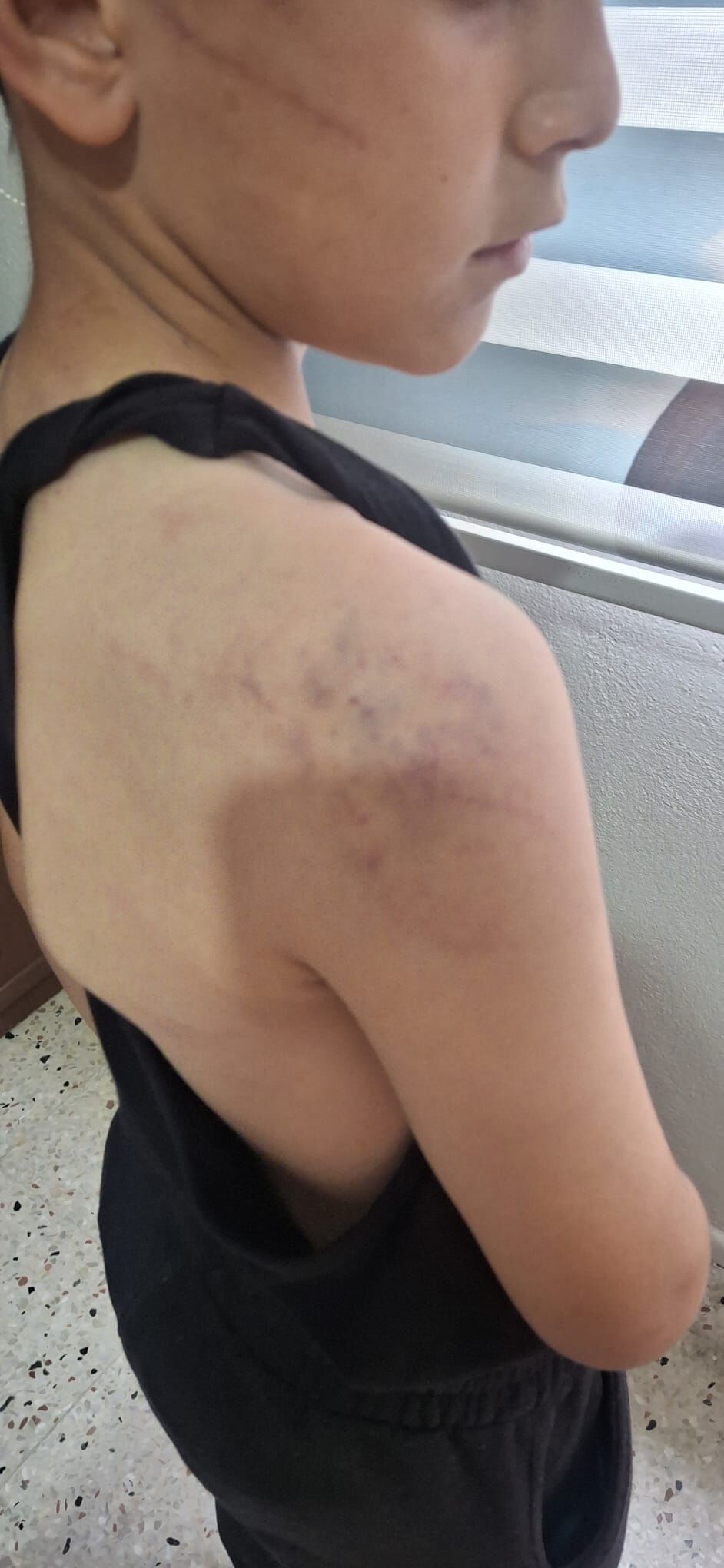 Manisa'da Aile İçi Şiddet Skandalı: Babasının Darbettiği 12 Yaşındaki R.B.D. Koruma Altına Alındı-2