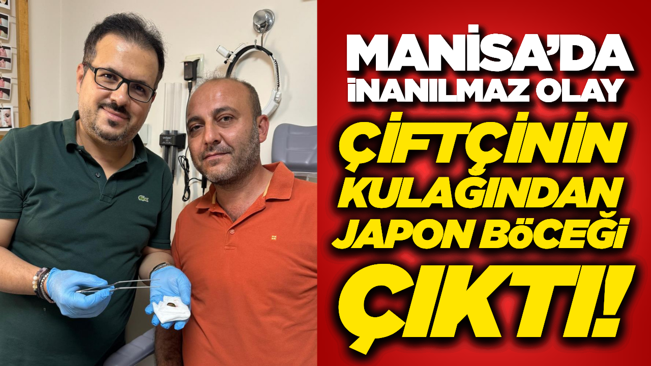 Manisalı Çiftçinin Kulağından "Japon Böceği" Çıkarıldı