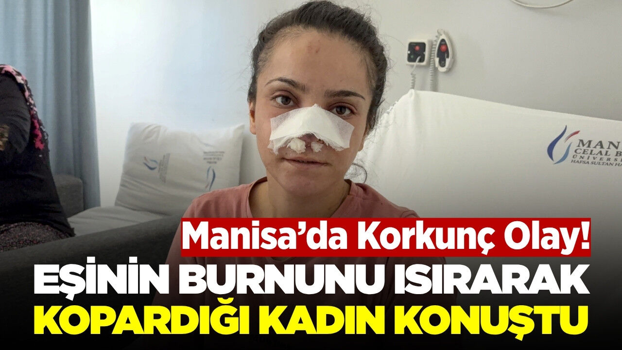 Manisa'da eşi burnunu ısırıp koparmıştı: Ameliyatla yerine dikildi