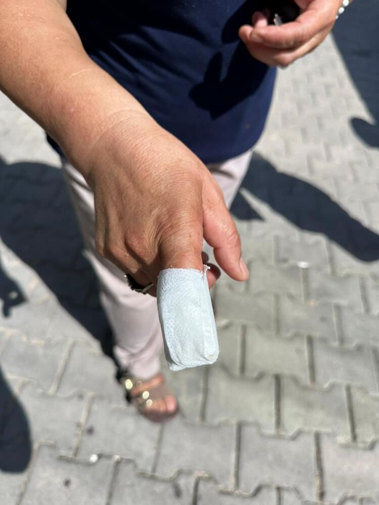 İzmir'de pitbull saldırısına uğrayan kadının parmağı koptu